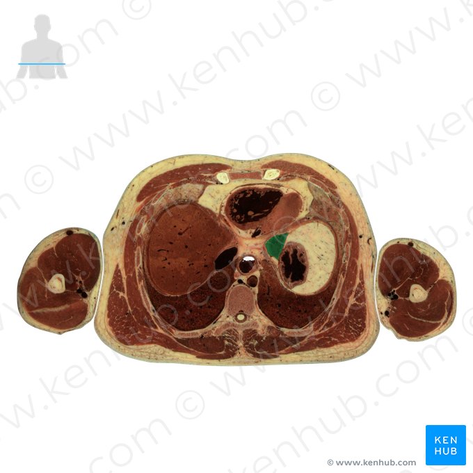 Left lobe of liver (Lobus sinister hepatis); Image: National Library of Medicine