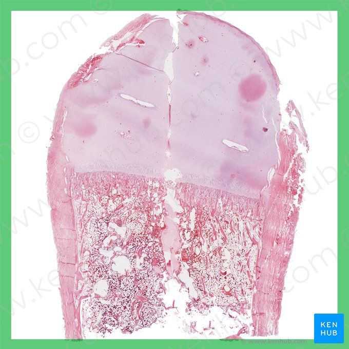 Osificación endocondral (Ossificatio endochondralis); Imagen: 