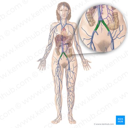 Common iliac vein (Vena iliaca communis); Image: Begoña Rodriguez