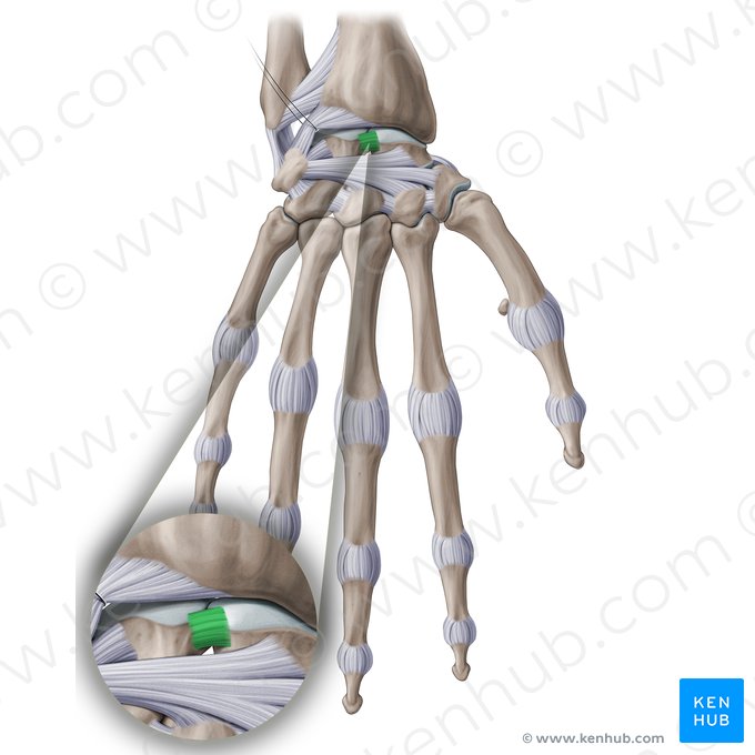Ligamento interósseo escafossemilunar (Ligamentum scapholunatum interosseum); Imagem: Paul Kim