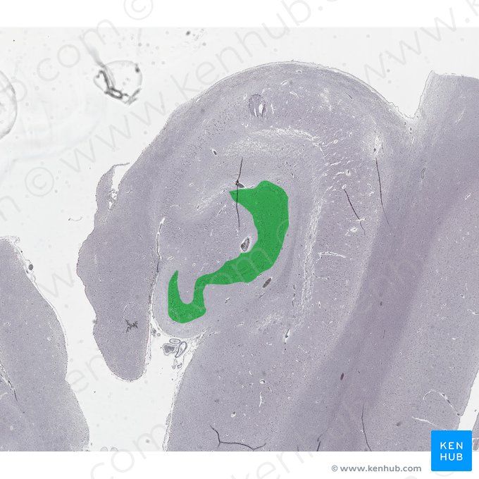 Giro dentado (Gyrus dentatus); Imagen: 