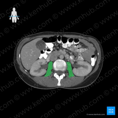 Músculo psoas maior (Musculus psoas major); Imagem: 