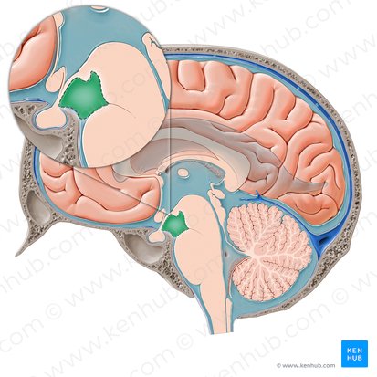 Interpeduncular cistern (Cisterna interpeduncularis); Image: Paul Kim