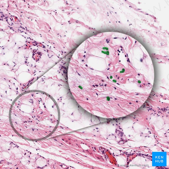 Fibroblasto (Fibroblastus); Imagem: 