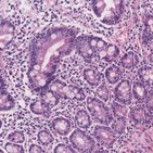Duodenum histology