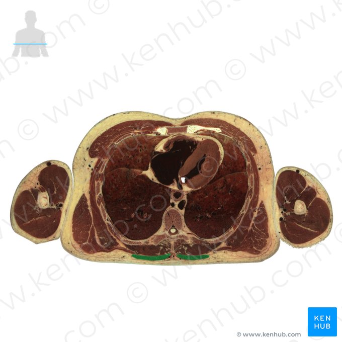 Musculus trapezius (Trapezmuskel); Bild: National Library of Medicine