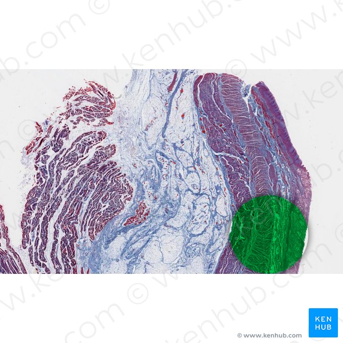 Cardia de l'estomac (Cardia gastris); Image : 