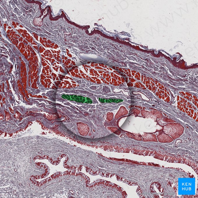 Tarsal muscle (Musculus tarsalis); Image: 