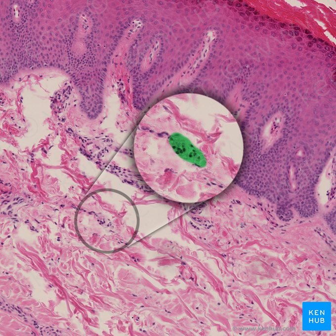 Bulbous (Ruffini) corpuscle (Corpusculum sensorium fusiforme); Image: 