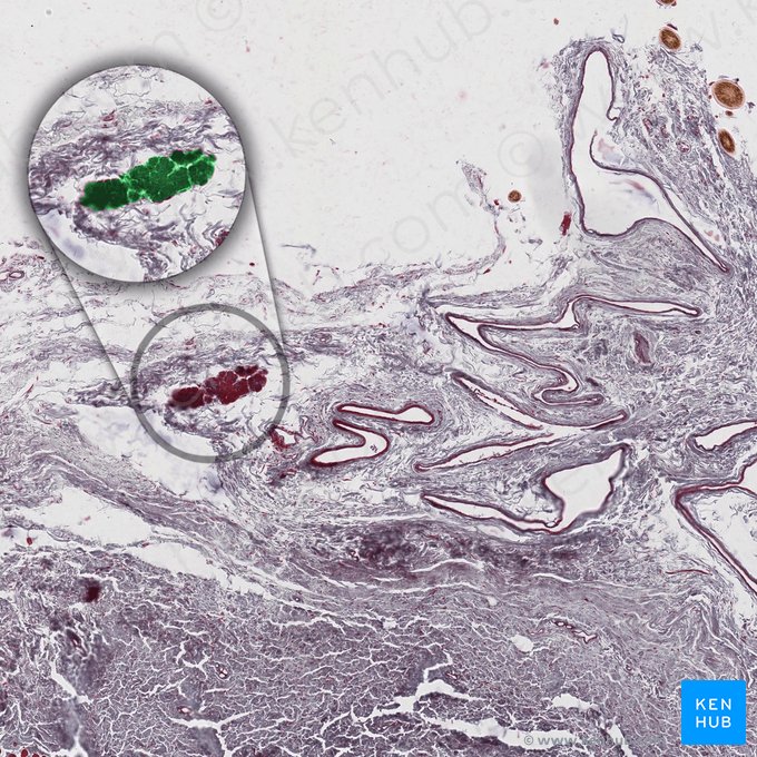 Glândula lacrimal acessória de Krause; Imagem: 