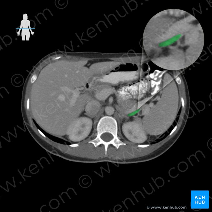 Splenic artery (Arteria splenica); Image: 