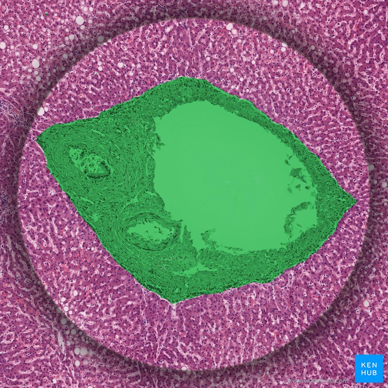 Portal triad - histological slide