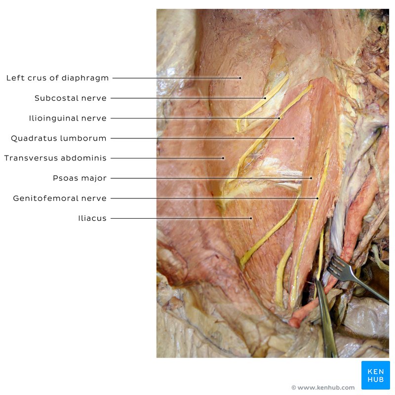 Ilioinguinal nerve and posterior abdominal wall in a cadaver