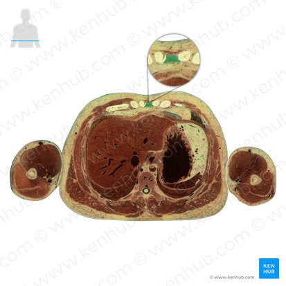 Sternum (Brustbein); Bild: National Library of Medicine