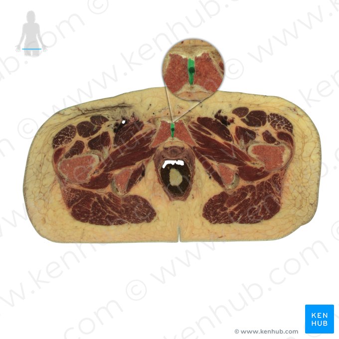 Pubic symphysis (Symphysis pubica); Image: National Library of Medicine