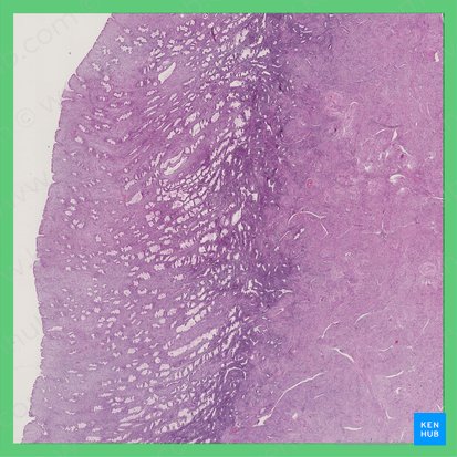 Phasis secretoria (Uterus) (Sekretionsphase des Uterus); Bild: 