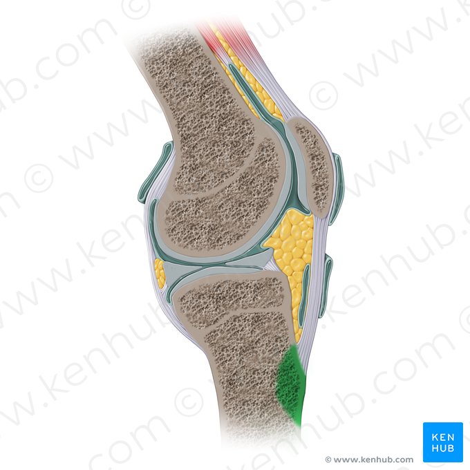 Tibial tuberosity (Tuberositas tibiae); Image: Paul Kim