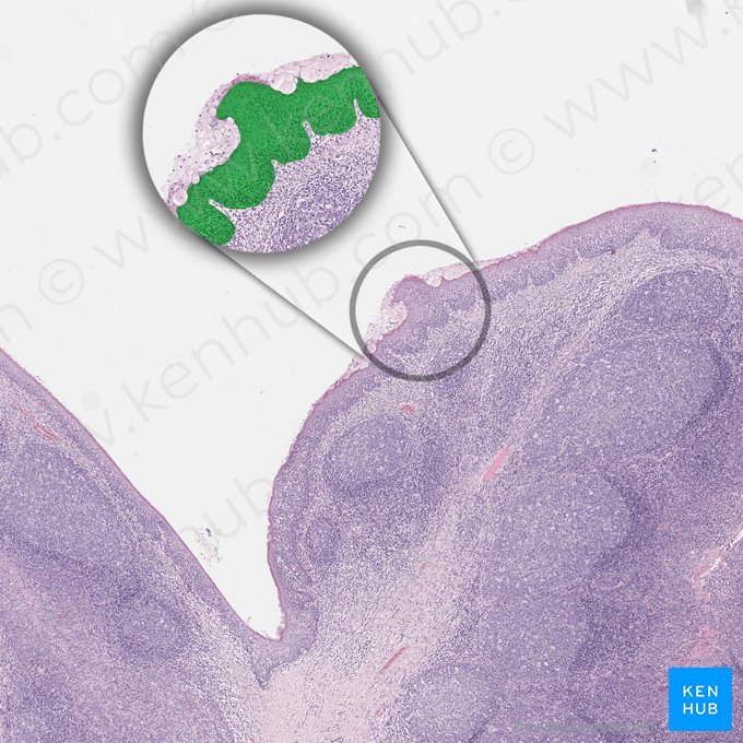 Epitélio escamoso estratificado não queratinizado (Epithelium stratificatum squamosum non cornificatum); Imagem: 