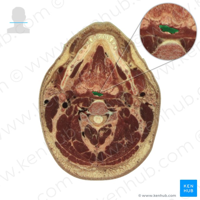 Oropharynx (Pars oralis pharyngis); Image: National Library of Medicine