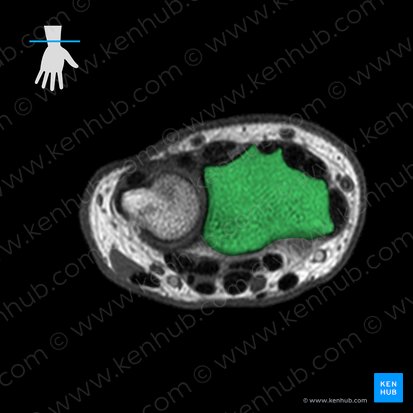 Radius; Image: 