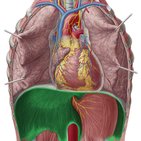 Hiatal hernia