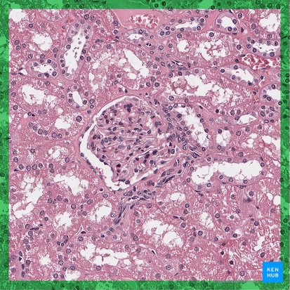 Renal corpuscle (Corpusculum renale); Image: 