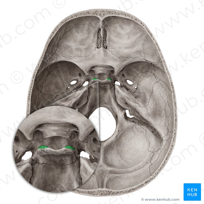 Posterior clinoid process of sphenoid bone (Processus clinoideus posterior ossis sphenoidalis); Image: Yousun Koh