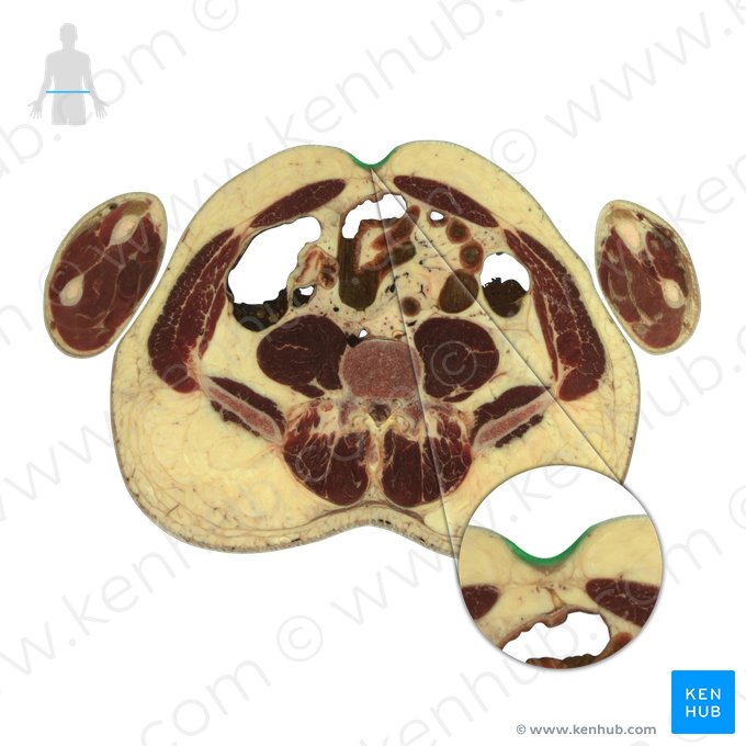 Umbilicus (Bauchnabel); Bild: National Library of Medicine