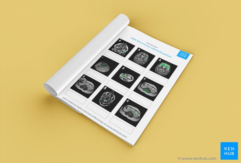 Test your ability to identify anatomical structures on an MRI with our unlabeled worksheet: Download below!