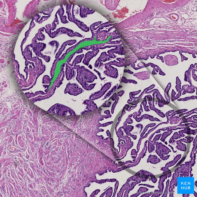 Lymphatic vessel (Vas lymphaticum); Image: 