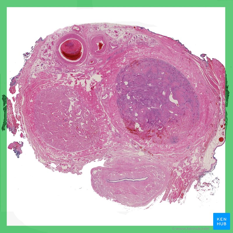 histología testicular