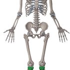 Das Osteosarkom