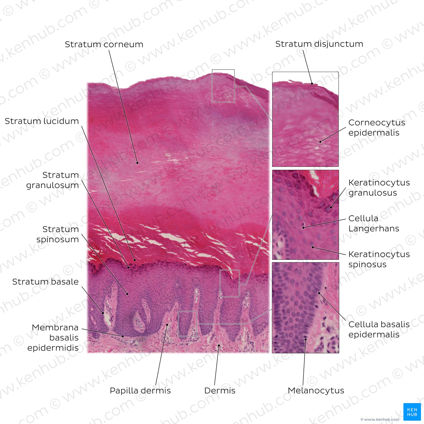 Layers of the epidermis. Stain: H&E. Medium magnification.