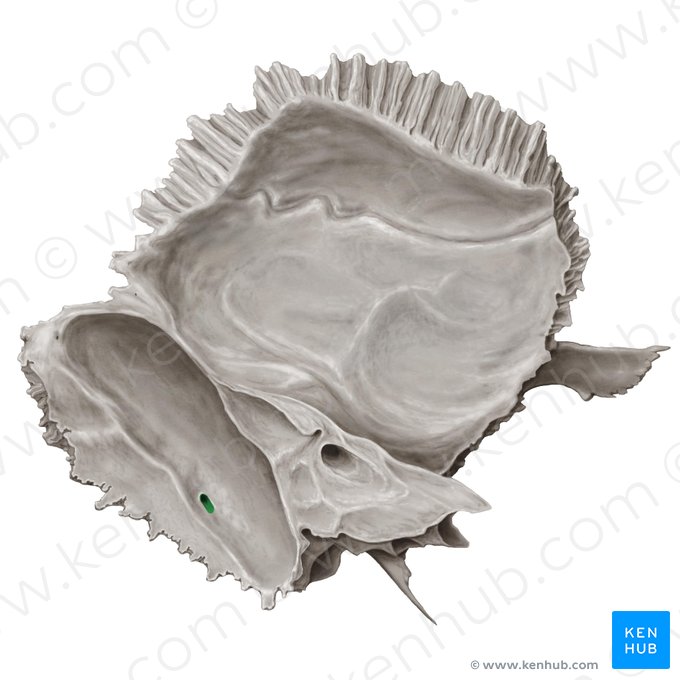 Foramen mastoideo del hueso temporal (Foramen mastoideum); Imagen: Samantha Zimmerman