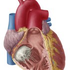 Conus arteriosus 