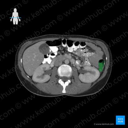 Descending colon (Colon descendens); Image: 