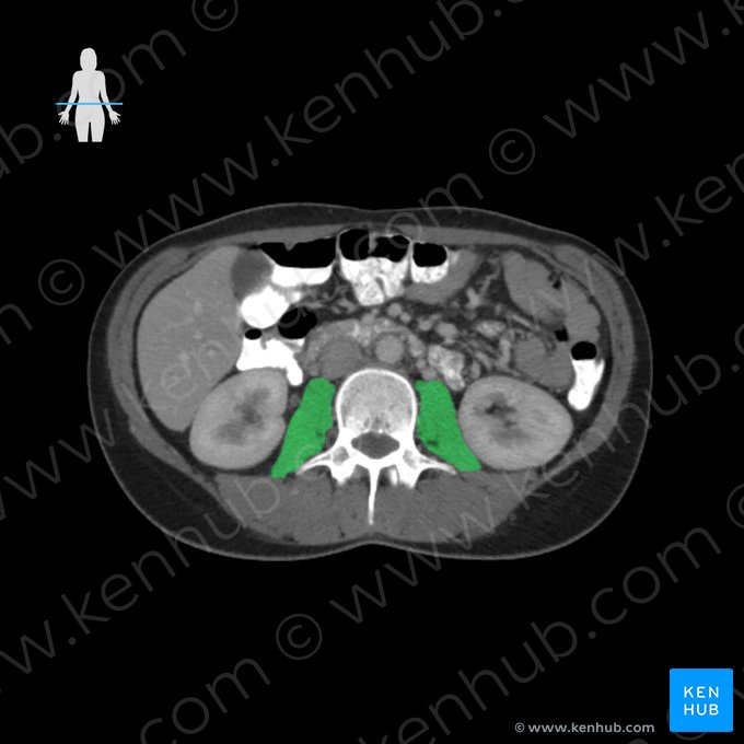 Psoas major muscle (Musculus psoas major); Image: 