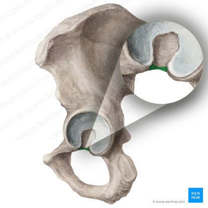 Incisura acetabular del hueso coxal (Incisura acetabuli ossis coxae); Imagen: Liene Znotina
