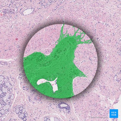 Dense irregular connective tissue; Image: 