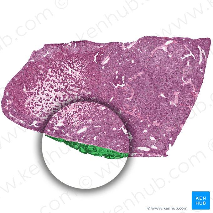 Lobule of parathyroid gland (Lobulus glandulae parathyroidae); Image: 