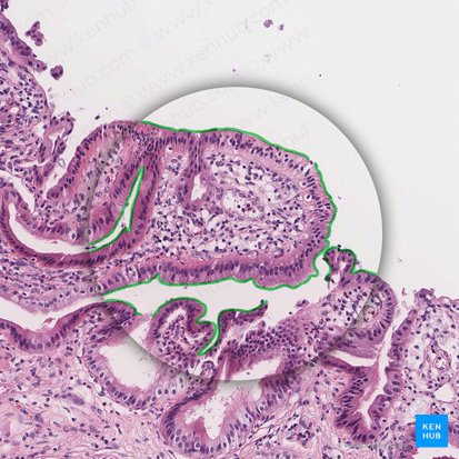 Microvilosidades (Microvilli); Imagem: 