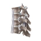 Costovertebral joints