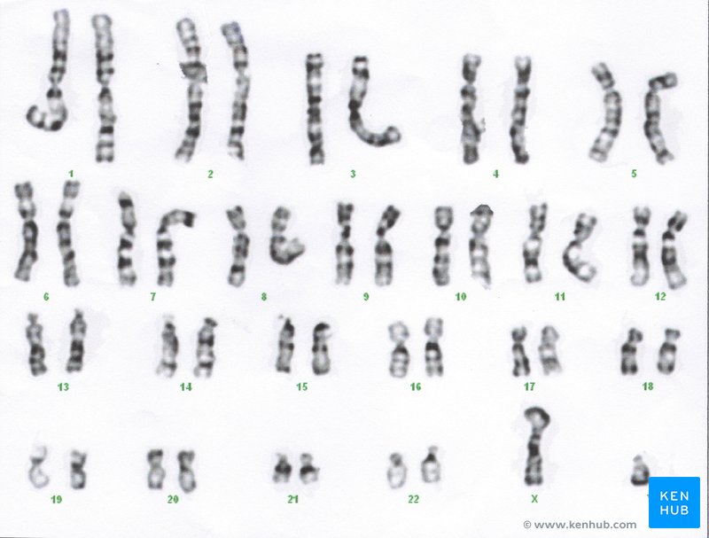 Human Karyotype