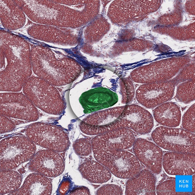 Arteria testicular (Arteria testicularis); Imagen: 