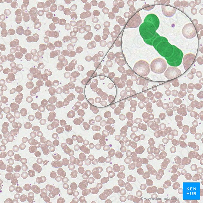 Eritrocitos en pilas de monedas (Strues erythrocytorum); Imagen: 