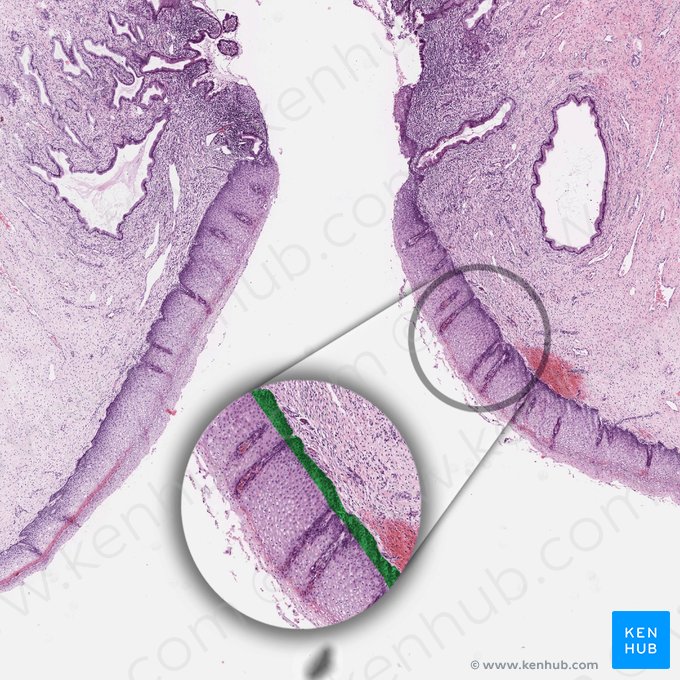 Capa basal del epitelio escamoso; Imagen: 