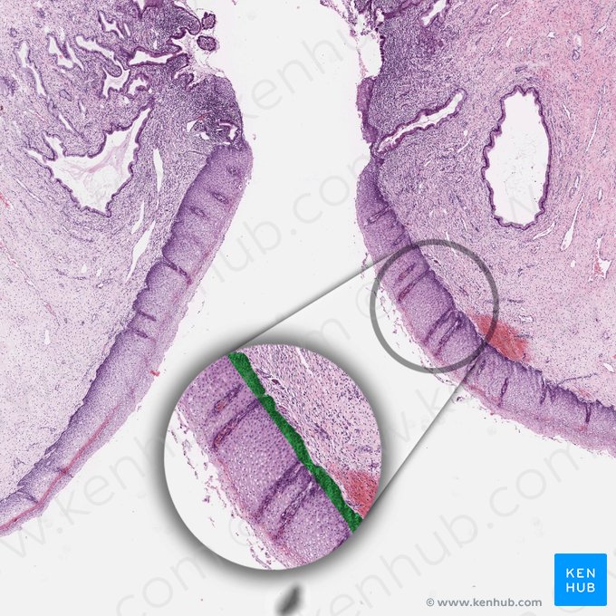 Basal cell layer of squamous epithelium; Image: 