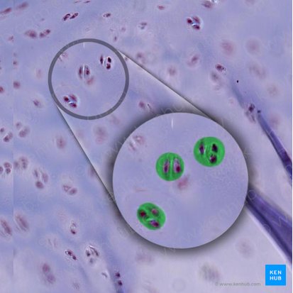 Cartilage lacuna (Lacuna cartilaginea); Image: 