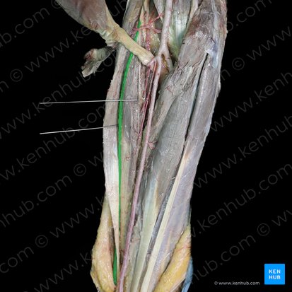 Rameau superficiel du nerf radial (Ramus superficialis nervi radialis); Image : 