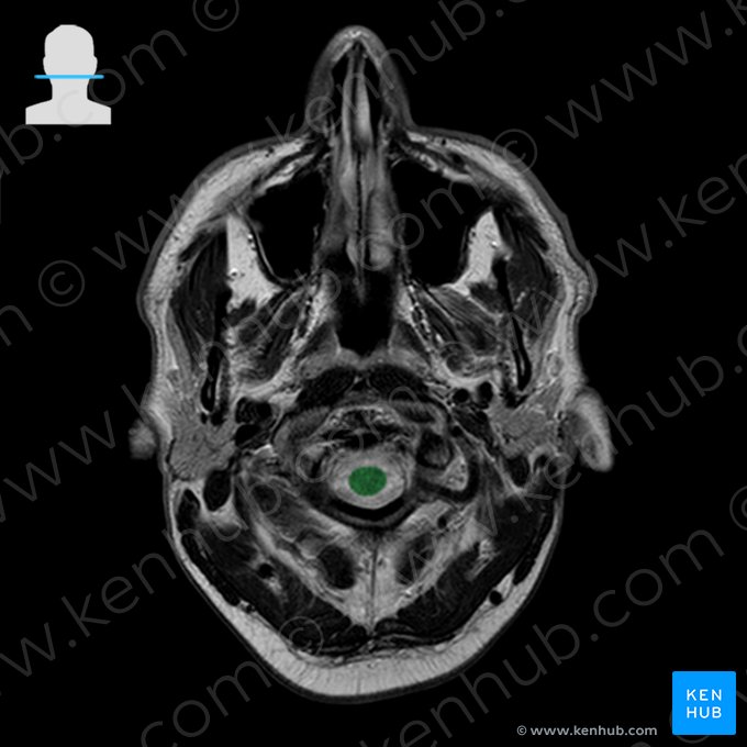 Spinal cord (Medulla spinalis); Image: 